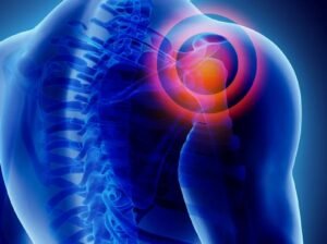 Steroid Joint Injections at a GP Clinic Private